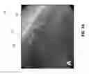 Fig. 28 - METHODS AND SYSTEMS FOR DETERMINING VASCULAR BODILY LUMEN INFORMATION AND GUIDING MEDICAL DEVICES
