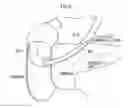 Fig. 06 - DIAGNOSIS SUPPORT APPARATUS, DIAGNOSIS SUPPORT METHOD, LESIONED PART DETECTION APPARATUS, AND LESIONED PART DETECTION METHOD