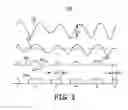 Fig. 04 - System and method for deriving respiration from intracardiac electrograms (EGM) or ECG signals