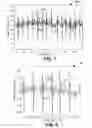 Fig. 08 - Visualization of electrophysiology data
