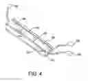 Fig. 05 - SEMI-RIGID COMPRESSION SPLINT FOR APPLICATION OF THREE-DIMENSIONAL FORCE