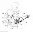 Fig. 01 - Shoulder orthosis including flexion/extension device