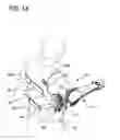 Fig. 02 - Shoulder orthosis including flexion/extension device