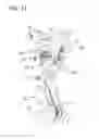 Fig. 20 - Shoulder orthosis including flexion/extension device