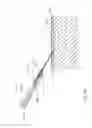 Fig. 17 - Medical device insertion apparatus, system and method