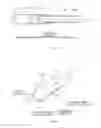 Fig. 08 - Tampon including a recessed part and method for manufacturing thereof