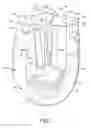 Fig. 02 - Disposable Absorbent Article with Opening Tab