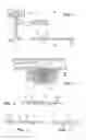 Fig. 02 - Transvenous Soaker Catheter Using Microfibers