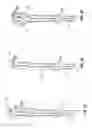 Fig. 04 - Microwave spacers and methods of use