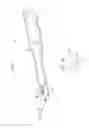 Fig. 08 - Electrosurgical cutting devices