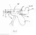 Fig. 07 - ERGONOMIC HANDPIECE FOR LAPAROSCOPIC AND OPEN SURGERY