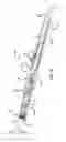 Fig. 09 - Surgical pencil enabling suction