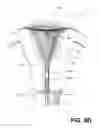 Fig. 12 - SYSTEMS AND METHODS FOR ENDOMETRIAL ABLATION