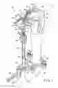 Fig. 02 - Flexible attachment for an extramedullary surgical instrument