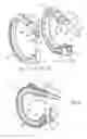 Fig. 04 - SURGICAL RING WITH ASSEMBLED CONSTRUCTION