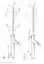 Fig. 02 - Systems and methods for removing obstructive matter from body lumens and treating vascular defects