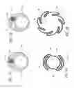 Fig. 03 - Systems and methods for removing obstructive matter from body lumens and treating vascular defects