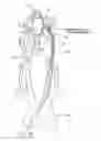 Fig. 07 - Systems and methods for removing obstructive matter from body lumens and treating vascular defects