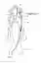 Fig. 08 - Systems and methods for removing obstructive matter from body lumens and treating vascular defects