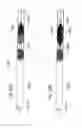Fig. 22 - Systems and methods for removing obstructive matter from body lumens and treating vascular defects