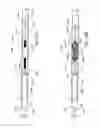 Fig. 30 - Systems and methods for removing obstructive matter from body lumens and treating vascular defects