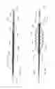 Fig. 34 - Systems and methods for removing obstructive matter from body lumens and treating vascular defects