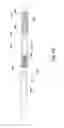Fig. 40 - Systems and methods for removing obstructive matter from body lumens and treating vascular defects