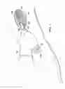 Fig. 02 - DEBRIDEMENT HAND TOOL