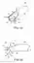 Fig. 04 - Method and apparatus for removing material from an intervertebral disc space and preparing end plates