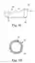 Fig. 05 - Method and apparatus for removing material from an intervertebral disc space and preparing end plates
