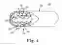 Fig. 06 - Method and apparatus for removing material from an intervertebral disc space and preparing end plates