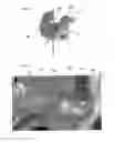 Fig. 03 - Method and device for acoustic sealing and occlusion effect mitigation