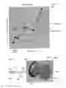 Fig. 09 - Method and device for acoustic sealing and occlusion effect mitigation