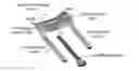Fig. 01 - Dorsal forearm plate