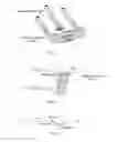 Fig. 03 - Dorsal forearm plate