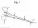 Fig. 02 - DePond clamp