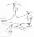 Fig. 01 - Surgical suture system