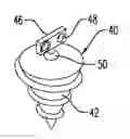 Fig. 01 - Surgical suture system