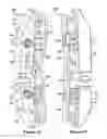Fig. 10 - SPINOUS PROCESS IMPLANT AND METHOD OF FIXATION