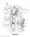 Fig. 12 - SPINOUS PROCESS IMPLANT AND METHOD OF FIXATION