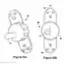 Fig. 17 - SPINOUS PROCESS IMPLANT AND METHOD OF FIXATION