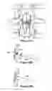 Fig. 19 - SPINOUS PROCESS IMPLANT AND METHOD OF FIXATION