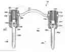 Fig. 01 - Rod attachement for head to head connector
