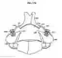Fig. 20 - Rod attachement for head to head connector