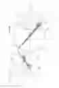 Fig. 03 - Process for introducing a stabilizing element into a vertebral column