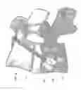 Fig. 09 - Process for introducing a stabilizing element into a vertebral column