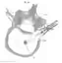 Fig. 19 - Process for introducing a stabilizing element into a vertebral column