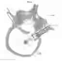 Fig. 20 - Process for introducing a stabilizing element into a vertebral column