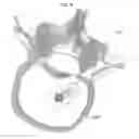 Fig. 22 - Process for introducing a stabilizing element into a vertebral column