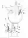 Fig. 30 - Process for introducing a stabilizing element into a vertebral column